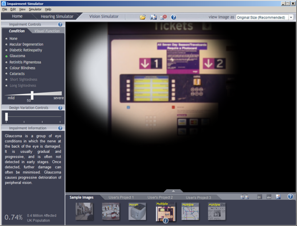 Screenshot of the impairment simulator software showing that glaucoma causes peripheral field loss