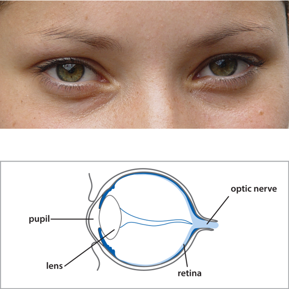 The eye contains a pupil and lens at the front, and a retina and optic nerve at the back